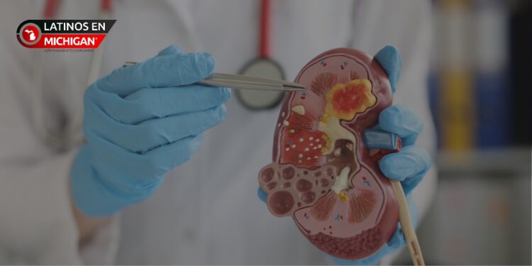 Uno de cada tres adultos en Michigan podría padecer enfermedad renal crónica. Se ofrecen exámenes gratuitos