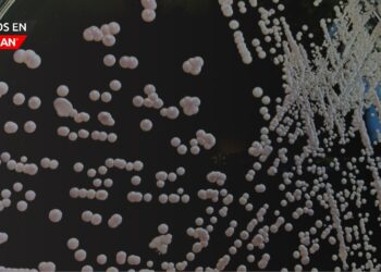 Aumentan infecciones por hongo altamente contagioso en EE.UU.