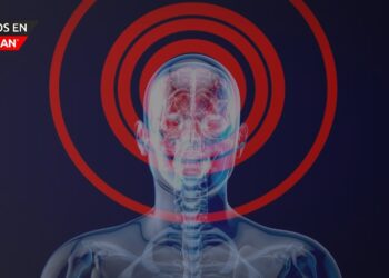 La American Stroke Association alerta sobre las señales del derrame cerebral y cómo prevenirlo